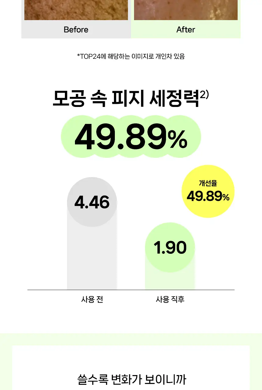 [엄지윤Pick/모공케어] 아크네스 모공 클리어 젤 클렌저 125ml 기획(+50ml) 상세페이지 14